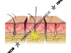 Центр эпиляции и маникюра "Epilas"